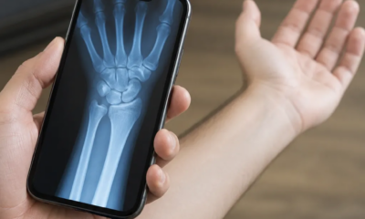Faça Raio-X pelo iPhone: Guia Completo