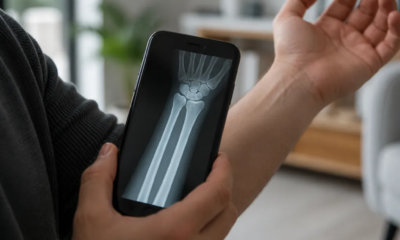 Simule Raio-X no Android: Apps e Dicas