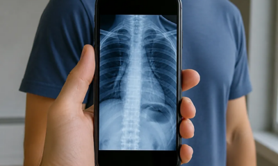 Simule Raio-X no Android: Veja Através