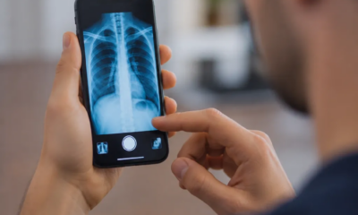 Simule Raio-X no iPhone: App para Radiografias