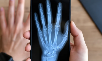 App Raio-X pela Câmera: Simule Exames no Celular