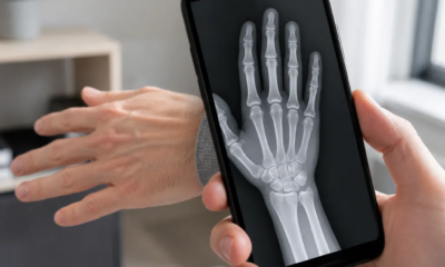 Aplicativo que simula raio-X pela câmera do seu celular