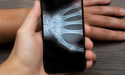 Aplicativo que simula raio-x pela câmera do seu Android agora