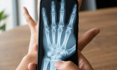 Aplicativo raio-x pela câmera do Android que simula radiografia real