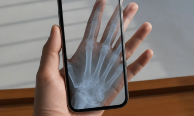 Aplicativo que simula raio-x pela câmera do seu Android agora