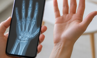 Simule Raio-X Pela Câmera do Seu Android Agora Mesmo