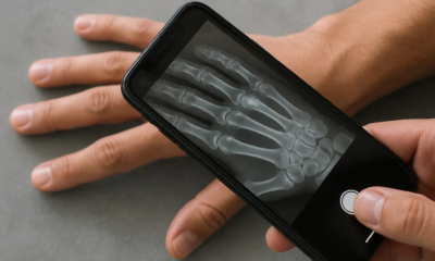 Como Simular Raio-X pela Câmera do Seu Celular: Guia Completo