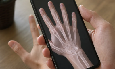 Veja os ossos através da câmera do seu celular agora
