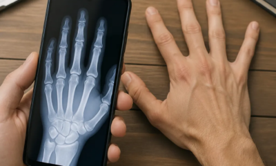 Aplicativo que simula raio-x pela câmera do Android revelado