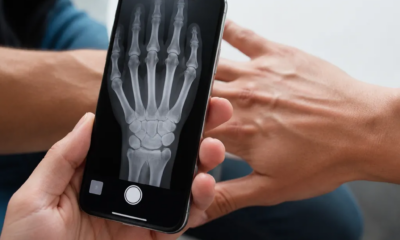 App raio-x para iPhone que finge radiografia com a câmera
