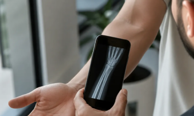 Veja como simular raio-x com a câmera do iPhone