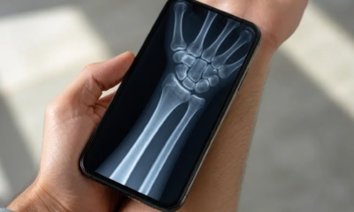 App Raio-X Ósseo para iPhone: Tecnologia de Escaneamento Avançado
