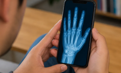 Simulador de Raio-X Grátis para iPhone: Teste Agora Mesmo