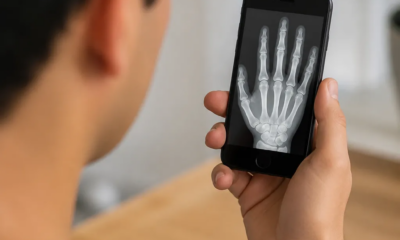 Como simular raio-x no iPhone usando a câmera facilmente