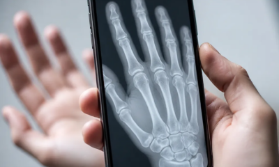 Câmera do iPhone revela estrutura óssea em tempo real