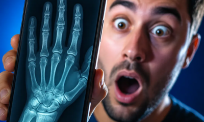 Simule Raio-X no Celular: Erros a Evitar